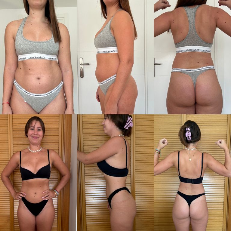Transformación real de Anne